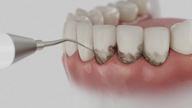 Reliable Dental contractor in Bridgeview, IL by Smile Center Dentistry